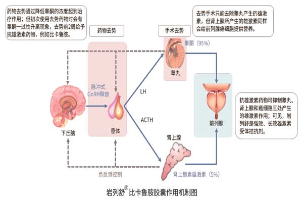前列腺癌,万象城AWC888,比卡鲁胺胶囊