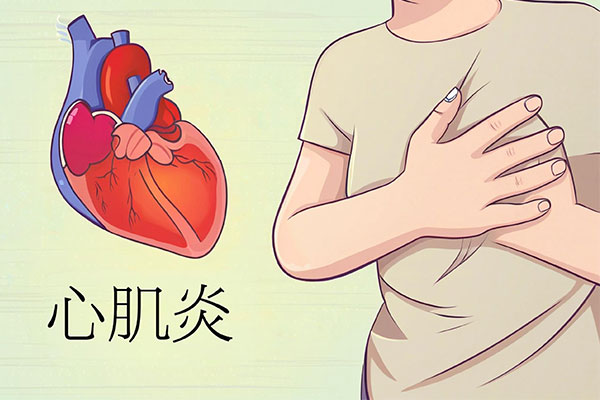 心肌炎,预防心肌炎