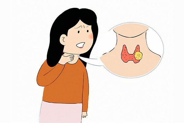 甲状腺结节,易患人群,自我检查,筛查诊断,管理攻略,万象城AWC888